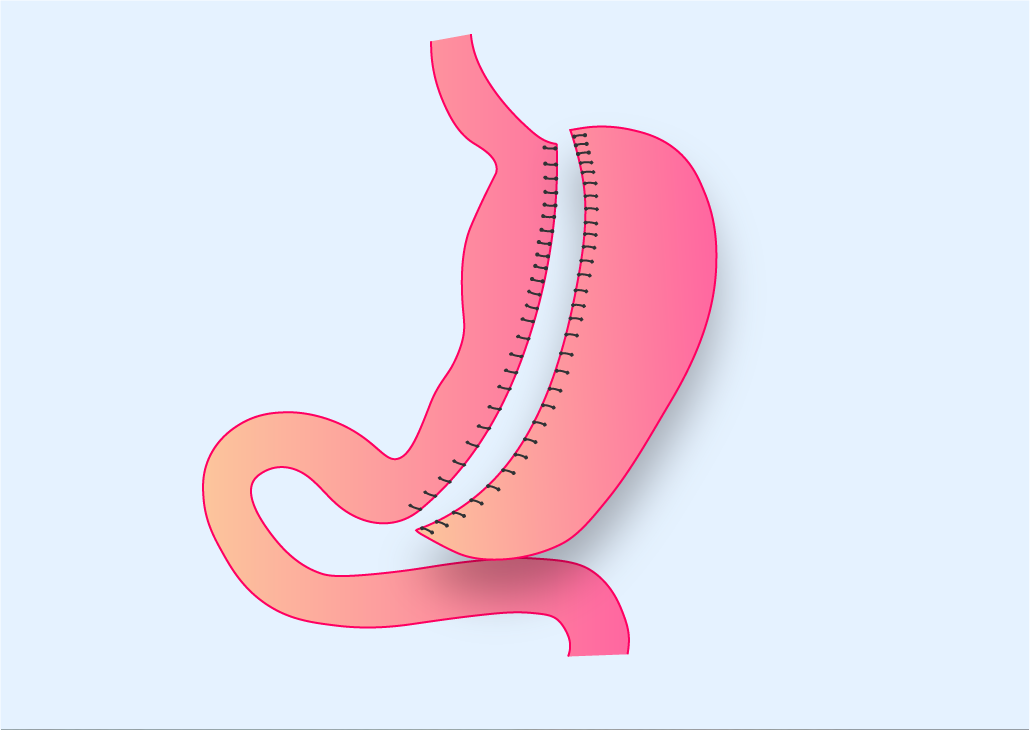 Gastric emptying delays pose surgery risks for semaglutide users - The DO