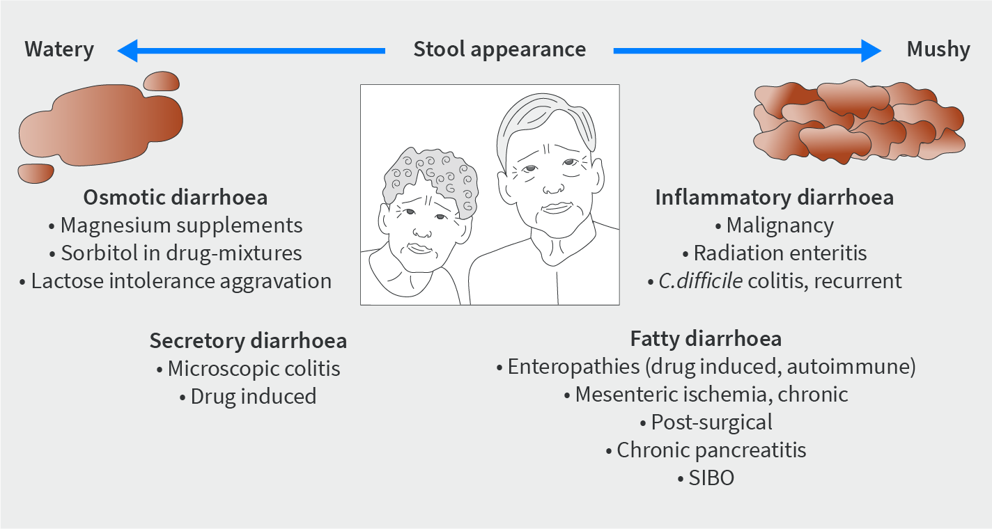 Figure 2 | Aetiologies of chronic diarrhoea that can be considered more frequently at an older age.