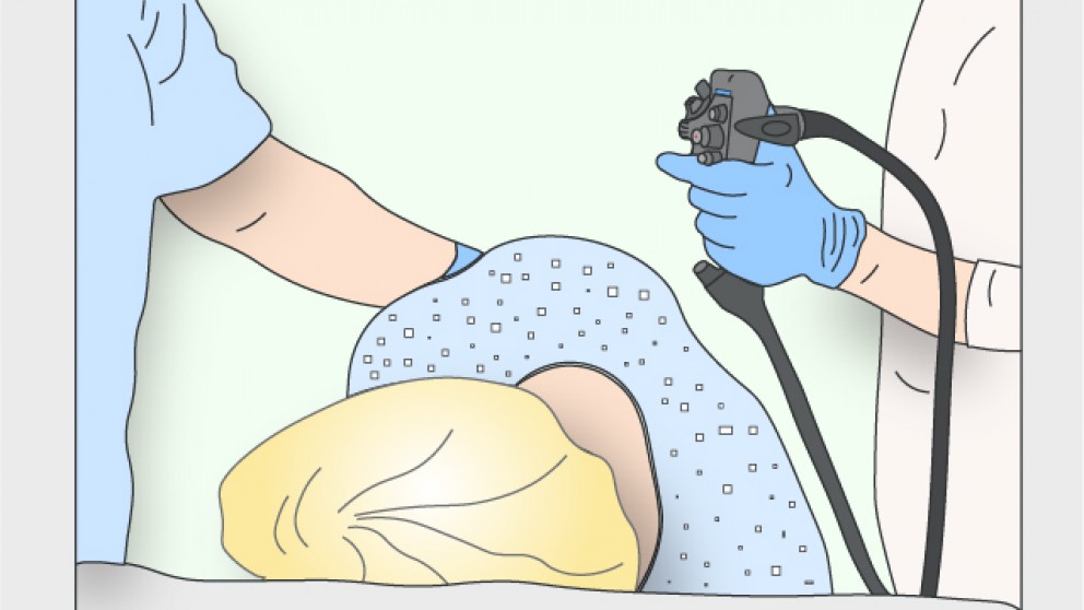 Mistakes in colonoscopy and how to avoid them