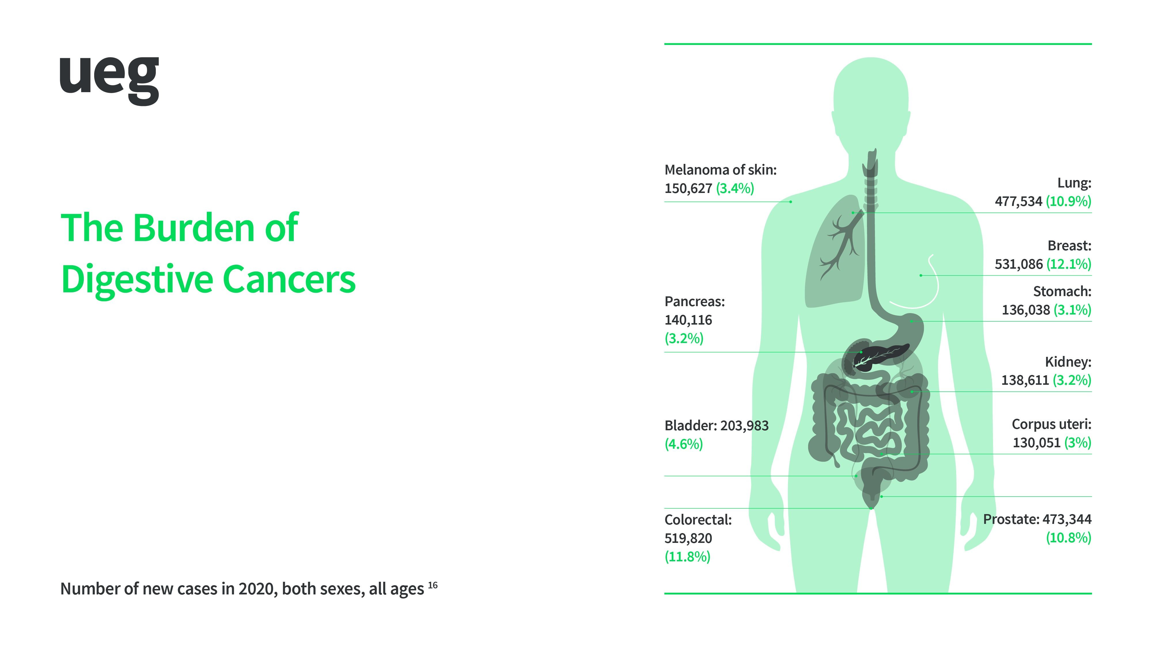 The burden of digestive cancers