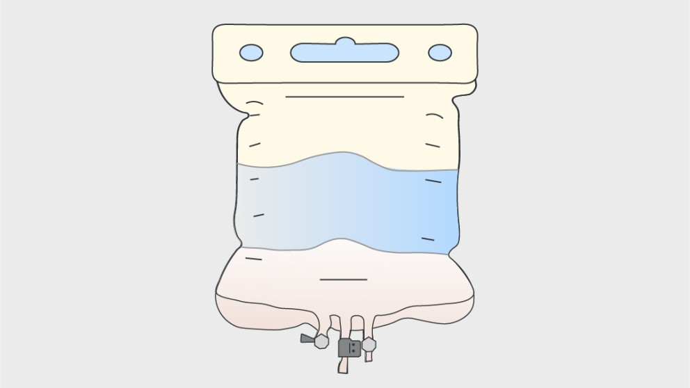 Mistakes in nutrition in IBD and how to avoid them