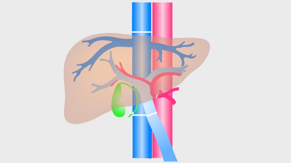 Mistakes in liver transplantation and how to avoid them