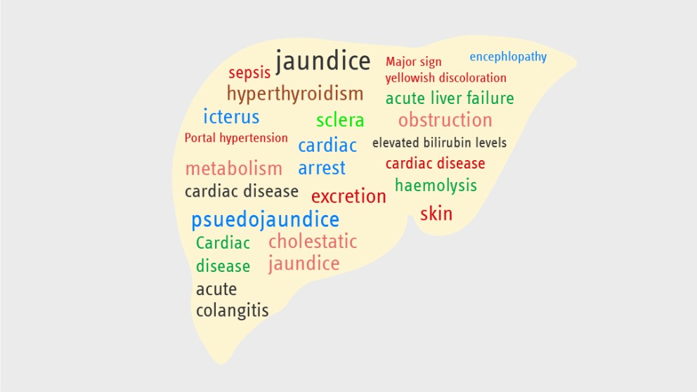 Mistakes in acute jaundice and how to avoid them