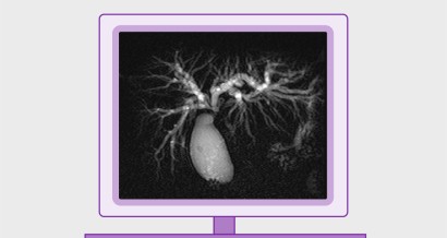 Mistakes in Pancreatobiliary Imaging and how to avoid them