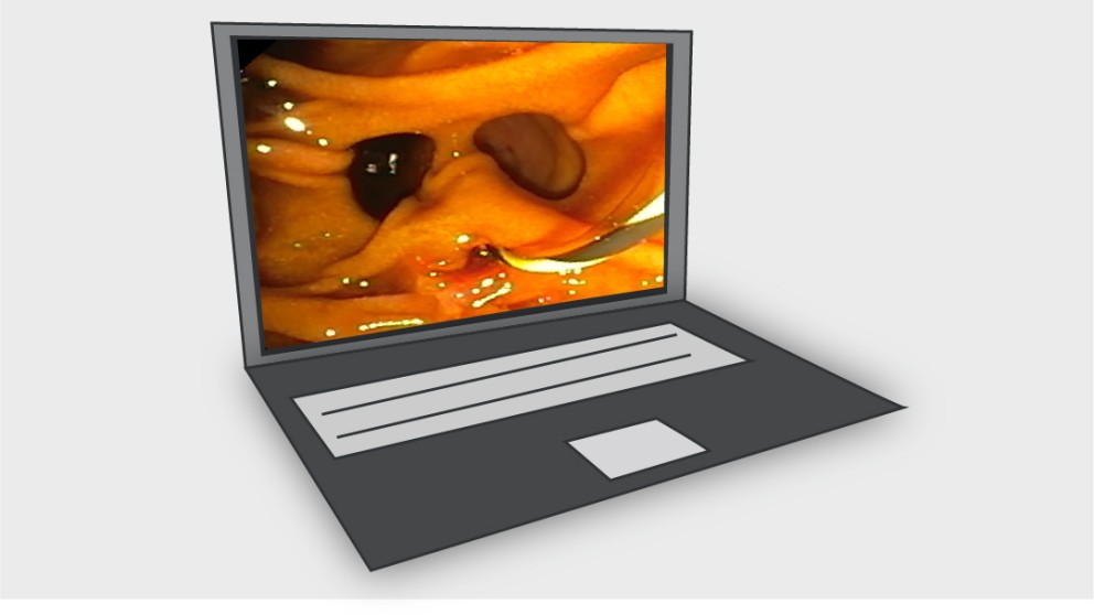 Mistakes in endoscopic retrograde cholangiopancreatography and how to avoid them