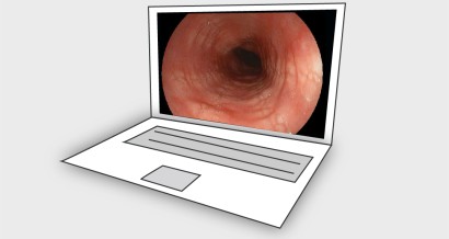 Mistakes in eosinophilic oesophagitis and how to avoid them