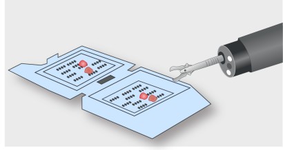 Mistakes in tissue acquisition during endoscopy and how to avoid them