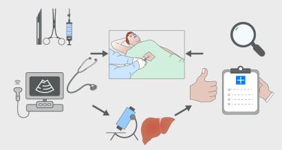 Liver biopsy