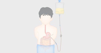 Gastrostomy insertion in children and adolescents and how to avoid them