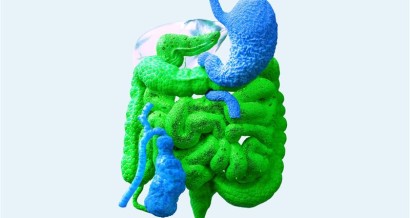 Inflammatory Bowel Disease