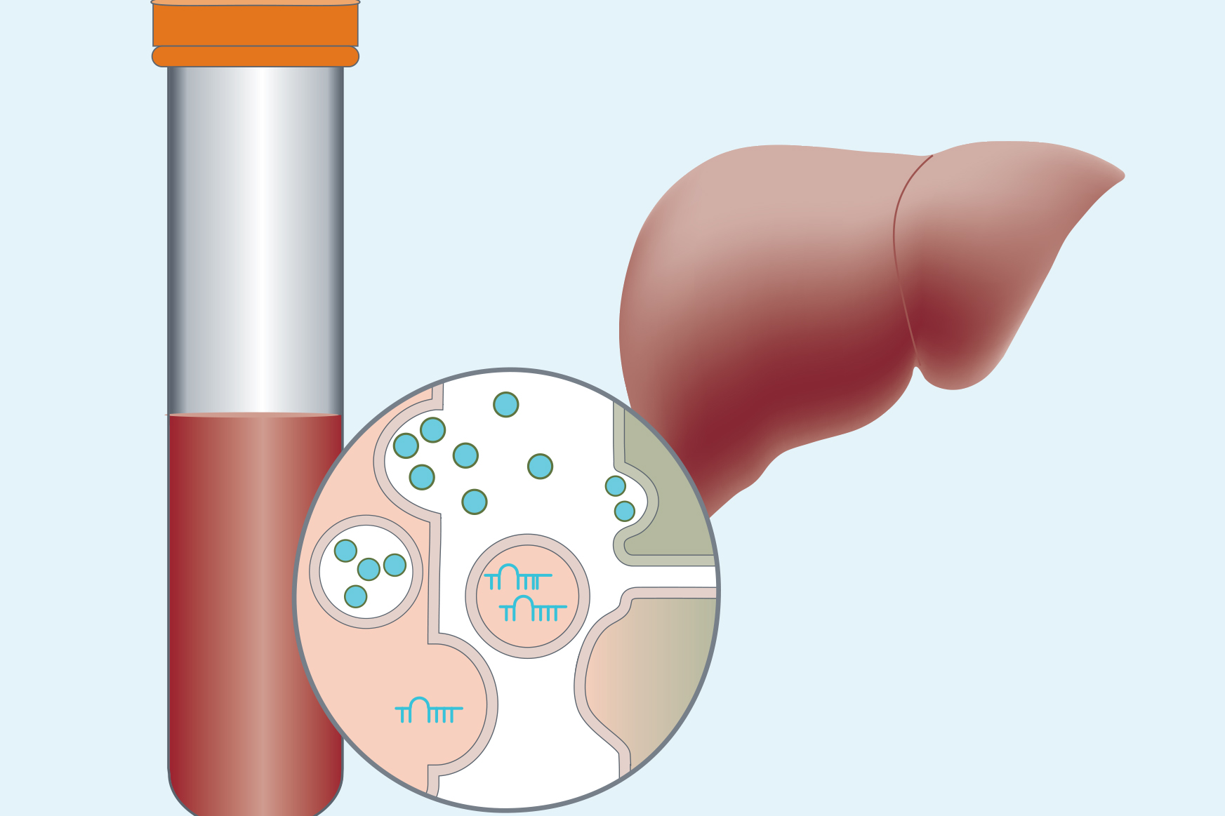 Biomarkers Of Liver Disease Ueg United European Gastroenterology 0886