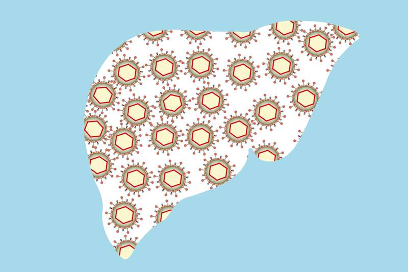 Mistakes In Chronic Hepatitis B Management And How To Avoid Them UEG 