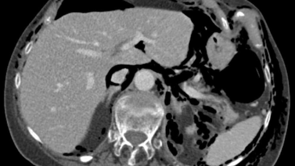 Mistakes In Series Ueg United European Gastroenterology 3436