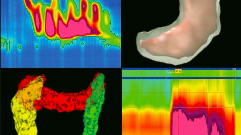 Mistakes in clinical investigation of gastrointestinal motility and function