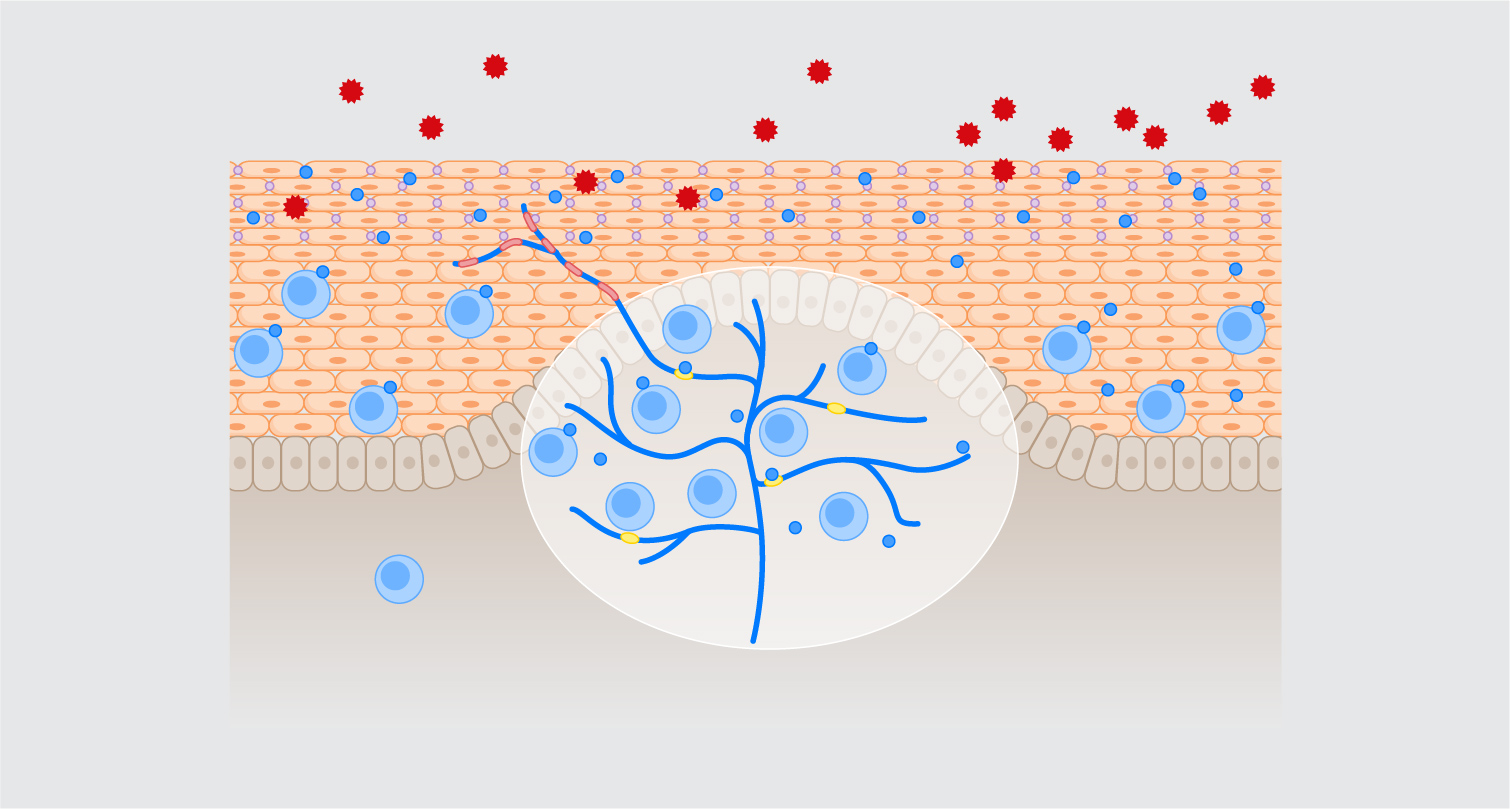GORD Pathophysiology  - Part 2