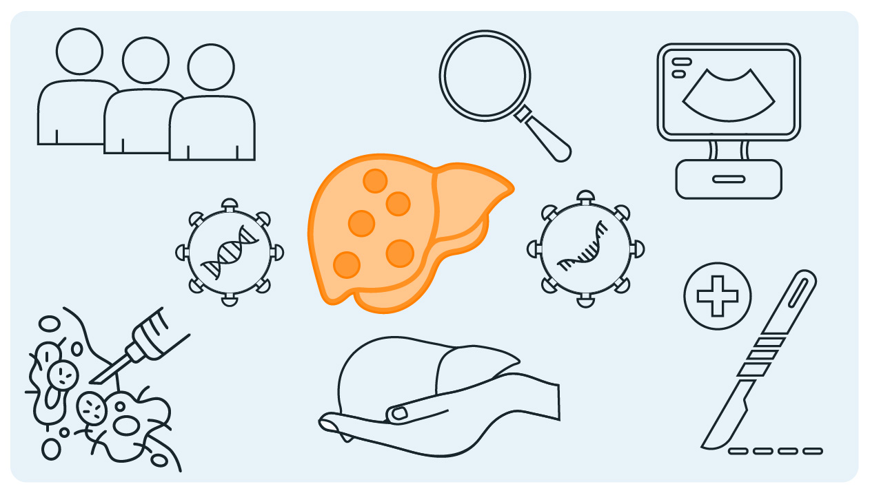 Mistakes in the management of hepatocellular carcinoma and how to avoid them